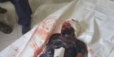استشهاد احد المتظاهرين برصاص مسلحي الاصلاح بمدينة قعطبة شمال محافظة الضالع
