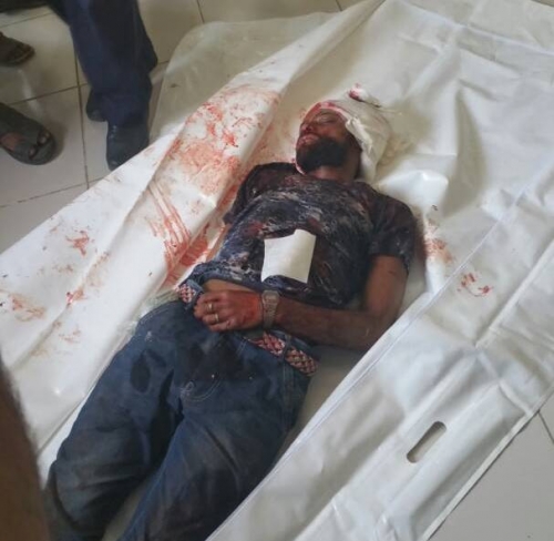 استشهاد احد المتظاهرين برصاص مسلحي الاصلاح بمدينة قعطبة شمال محافظة الضالع