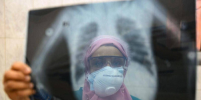 وزارة الصحة المصرية تسجل 21 وفاة و399 إصابة جديدة بـ"كورونا"