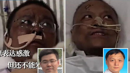 الصين .. وفاة طبيب تسبب فيروس كورونا بتغيير لون جلده في ووهان
