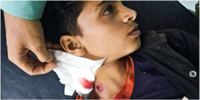 الحوثيون يستهدفون أطفال الضالع بقذائف الموت: 3 ضحايا أبرياء في انفجار مقذوف!