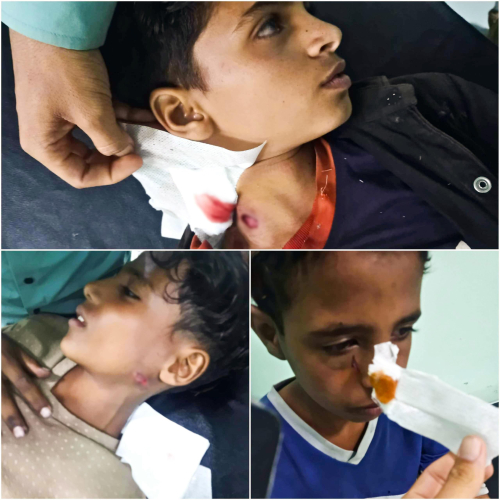 الحوثيون يستهدفون أطفال الضالع بقذائف الموت: 3 ضحايا أبرياء في انفجار مقذوف!