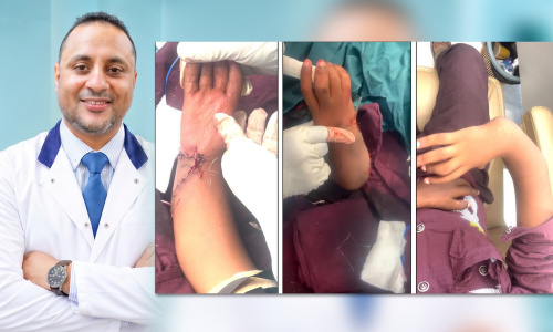 بعد أن فقدت أسرته الأمل.. الدكتور عماد الشعيبي يحقق إنجازاً طبياً في عدن وينهي معاناة طفل استمرت 13 عاماً